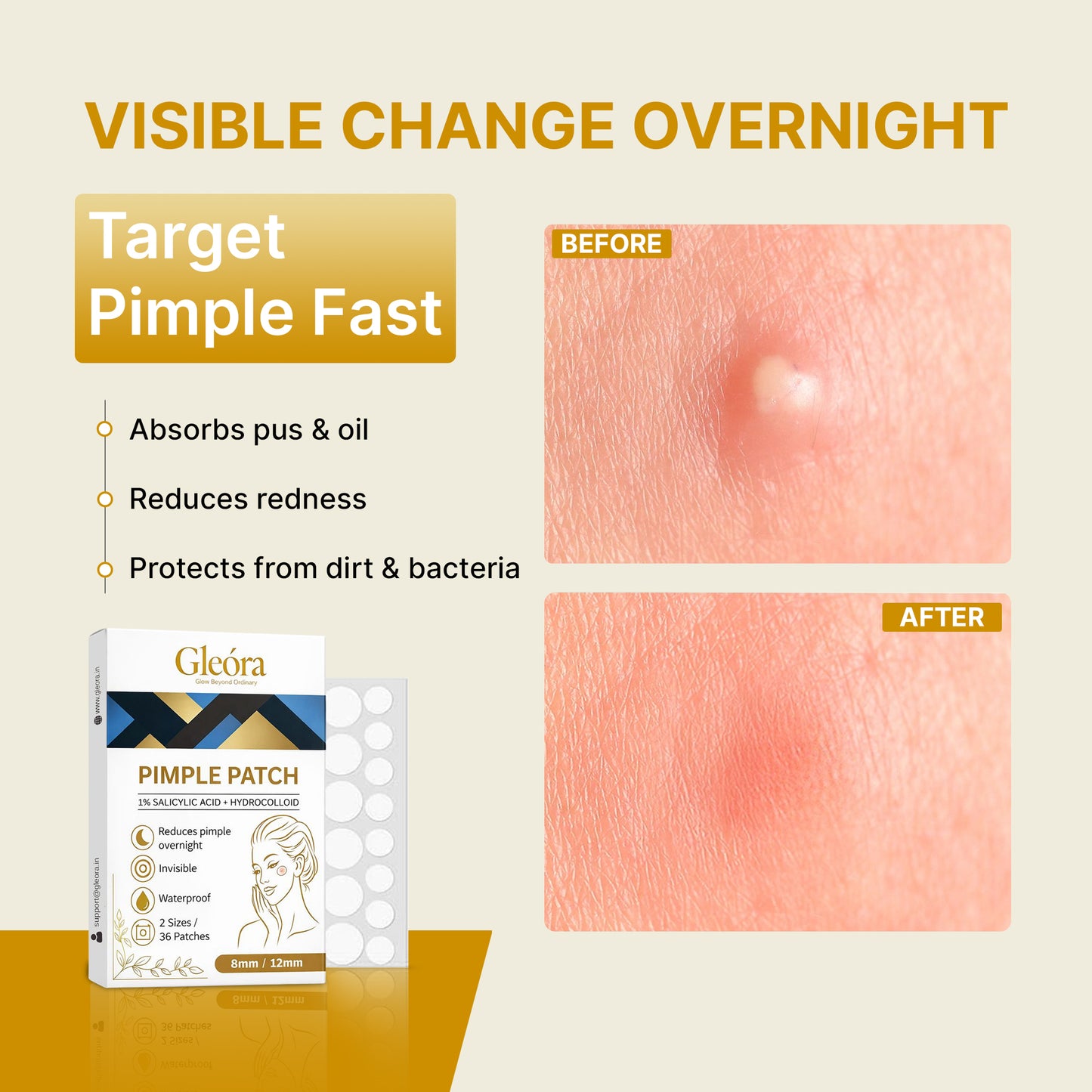 Gleóra Pimple Patch (36 Patches) Acne Spot Treatment | Invisible, Waterproof, Overnight Pimple Removal (8mm & 12mm)