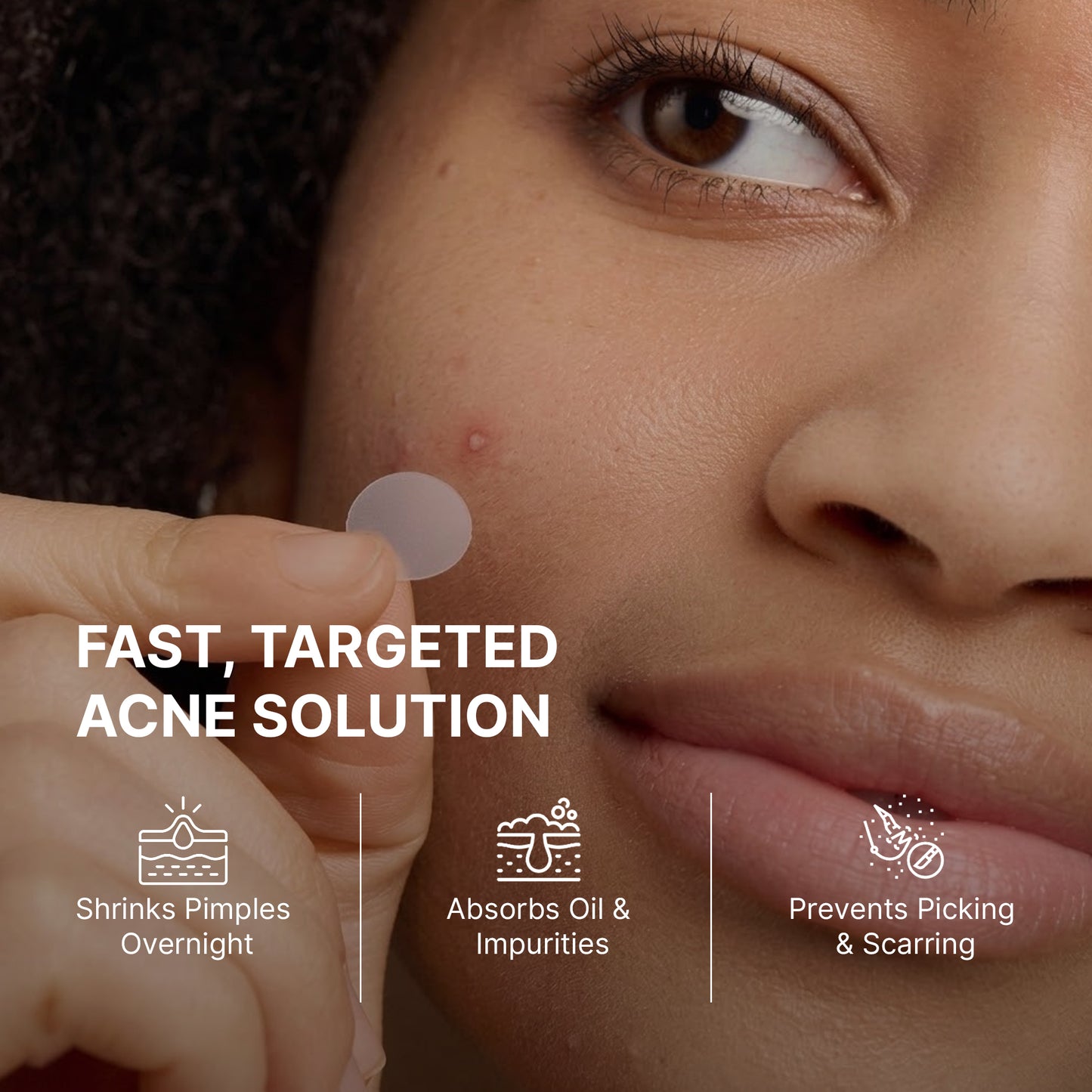 Gleóra Pimple Patch (36 Patches) Acne Spot Treatment | Invisible, Waterproof, Overnight Pimple Removal (8mm & 12mm)
